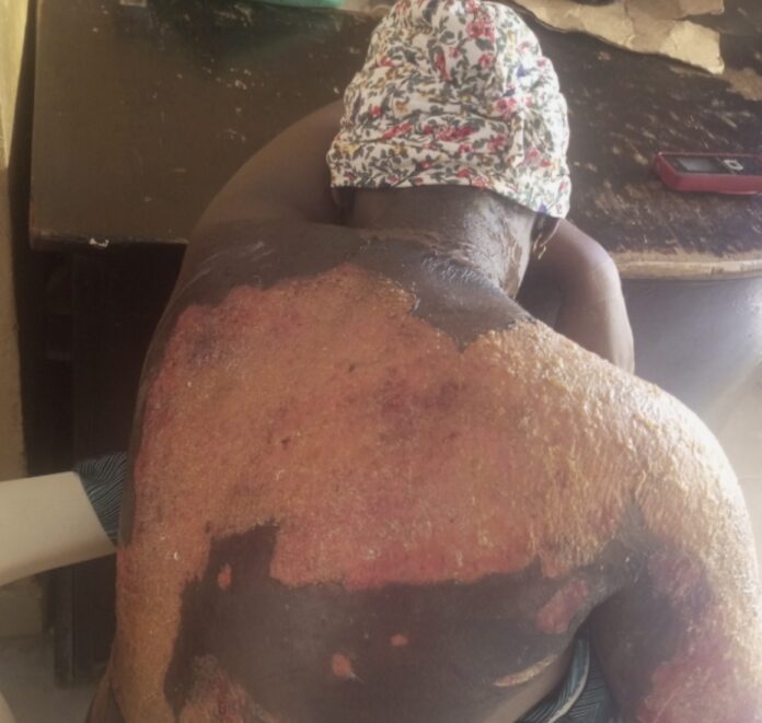 20-year-old lady pours hot water on brother's pregnant wife over disagreement