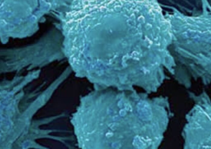 WHO advocates increased efforts to reduce cancer-related deaths
