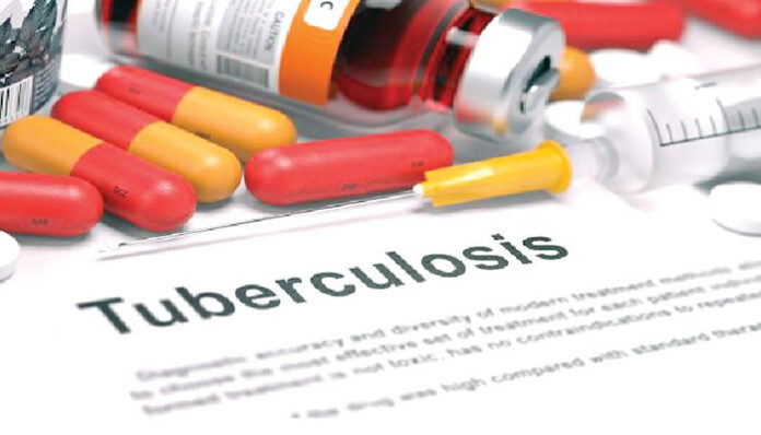 Funding cut threat to global TB efforts - WHO