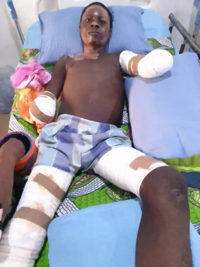 Taraba poly student loses hands to electrocution while hoisting PDP flag